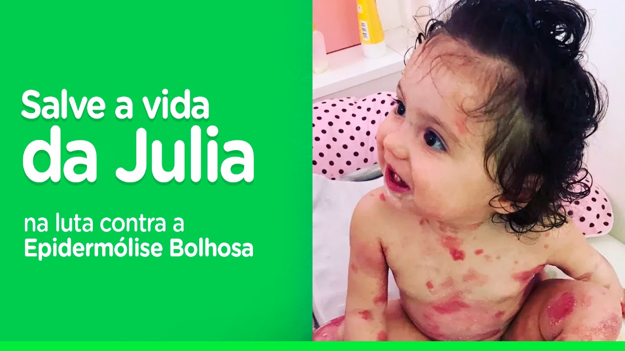 Ajude a Júlia na luta contra a Epidermólise Bolhosa! 💖